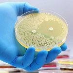 AI discovers potent new antibiotic to combat superbugs
