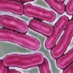Busseto Foods Recalls 11,000 Pounds of Charcuterie Products Linked to Salmonella Outbreak
